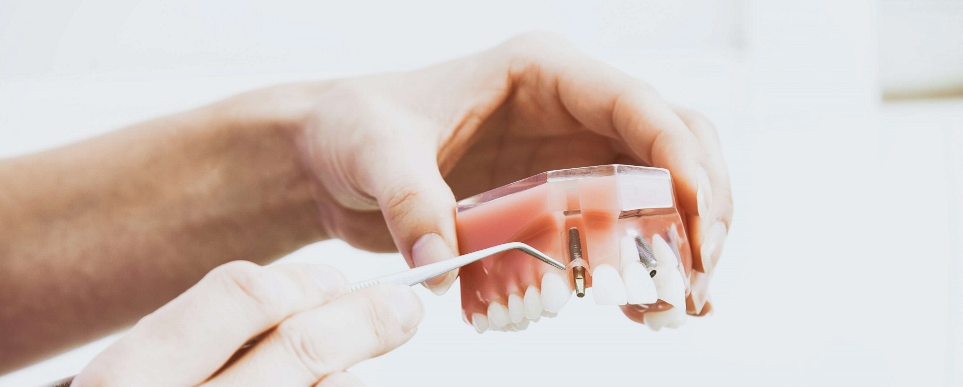DAGS | Zubni implanti Beograd